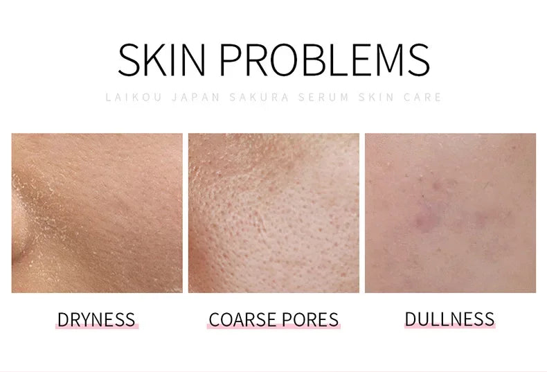 LAIKOU Cherry Blossom ou Rose Essence Solution